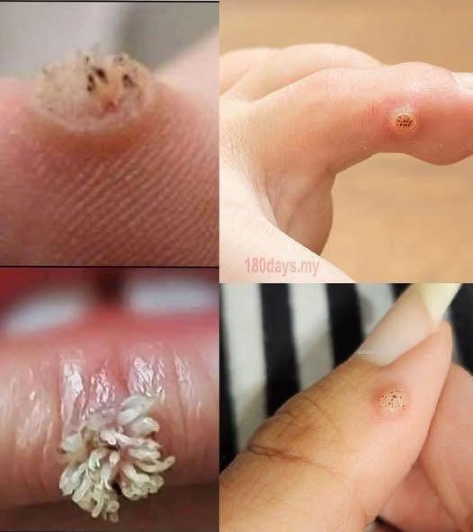 BE VERY CAREFUL 🤧🤧 . If you get this, you are infected with …. See more