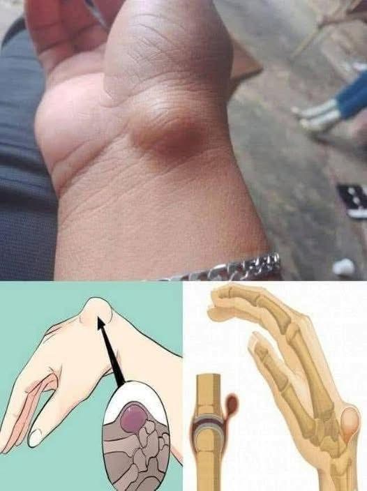 BE CAREFUL, If you spot these dots on your skin, it means you have Ca…see more