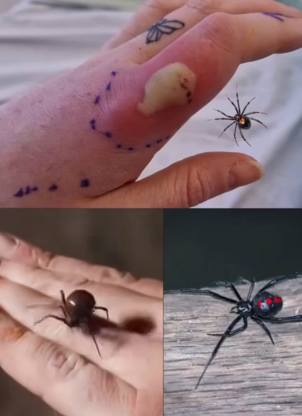 What To Do If You Get Bit.ten By A Black Widow Spider: A Complete Guide