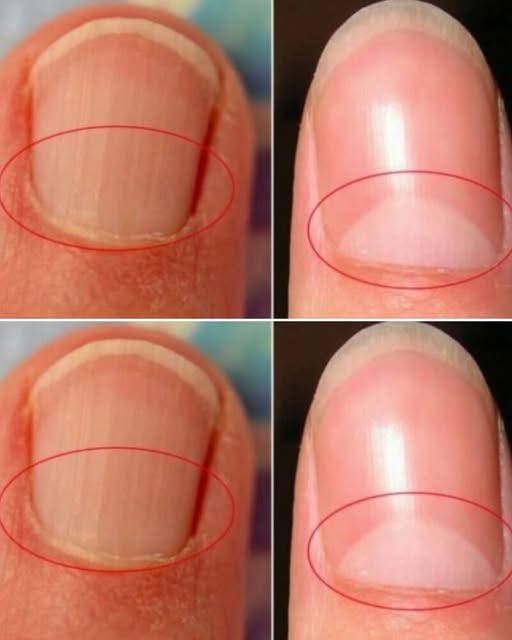 What Does the Half-Moon at the Base of Your Nails Really Mean?