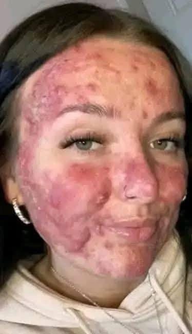 His body was itchy, he thought it was an allergy