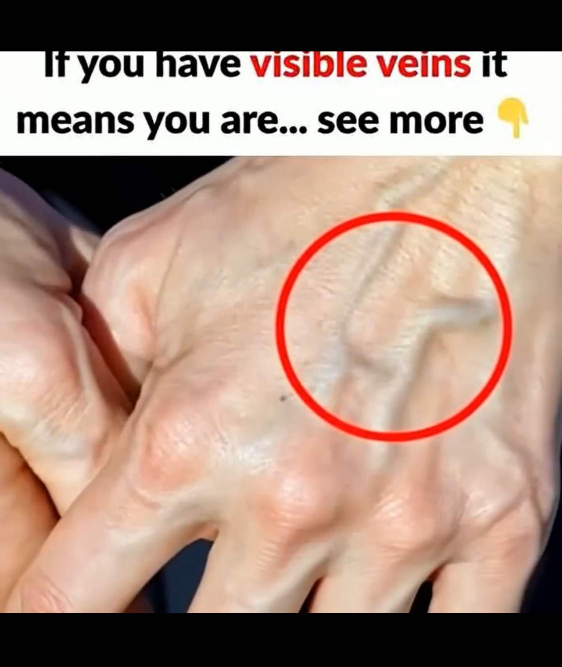 When to be concerned about Blood vessels that suddenly become visible