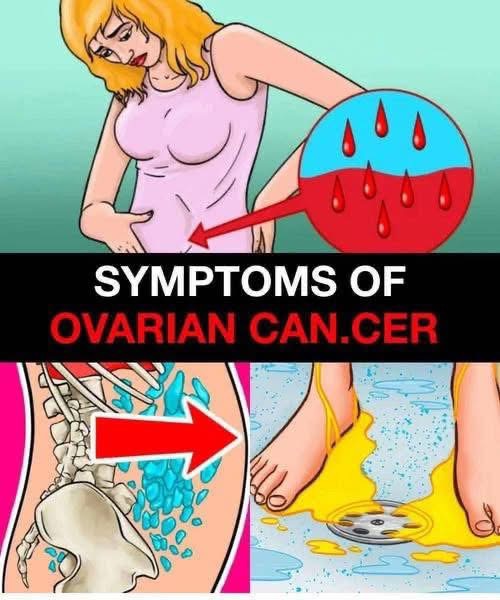 Symptoms of Ovarian Can.cer… See more in 1st comment