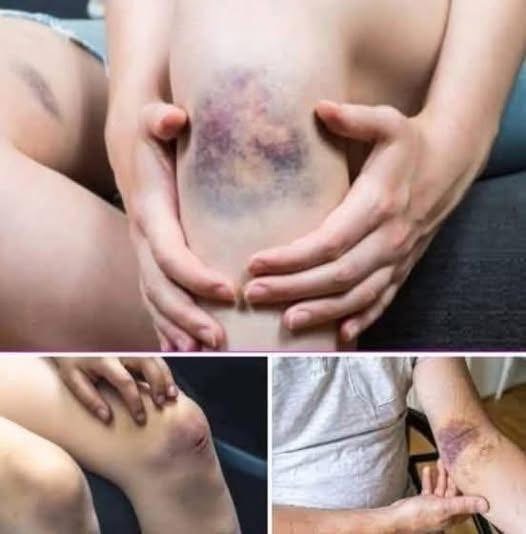 If your dog is sniffing your genital area, it means you have… s2
