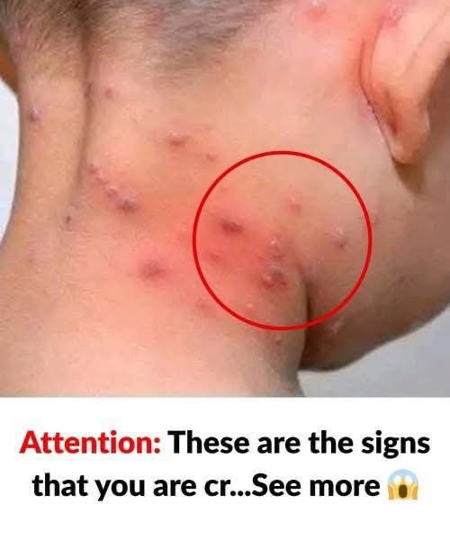 Do you know the main types of skin ras.hes? Find out what they are and what causes them