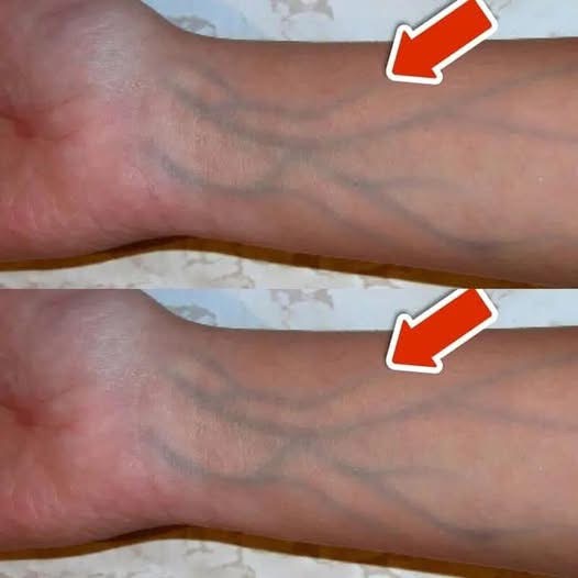 5 signs of poor circulation that you should NEVER ignore