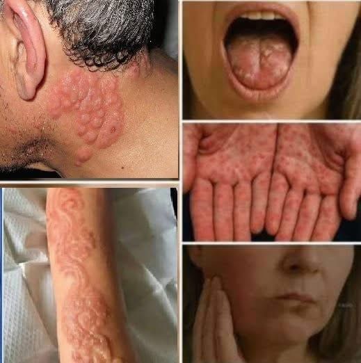 Symptoms You Should Never Ignore: What They Might Be Telling You