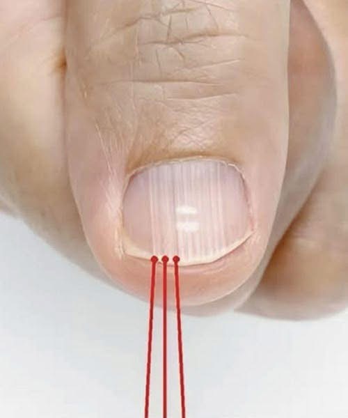 What Those Vertical Ridges on Your Fingernails Might Be Telling You — Especially After 40