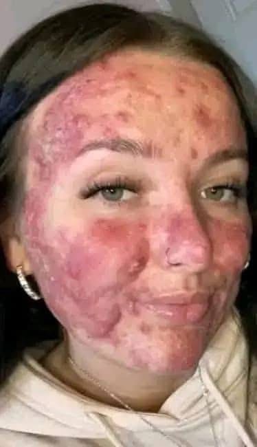 Her body was itchy, he thought it was an allergy!