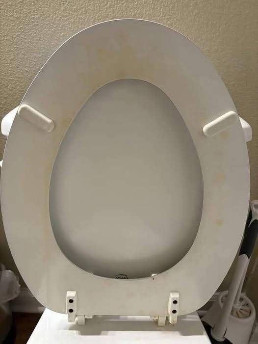 How I Successfully Removed Those Annoying Yellow Toilet Stains