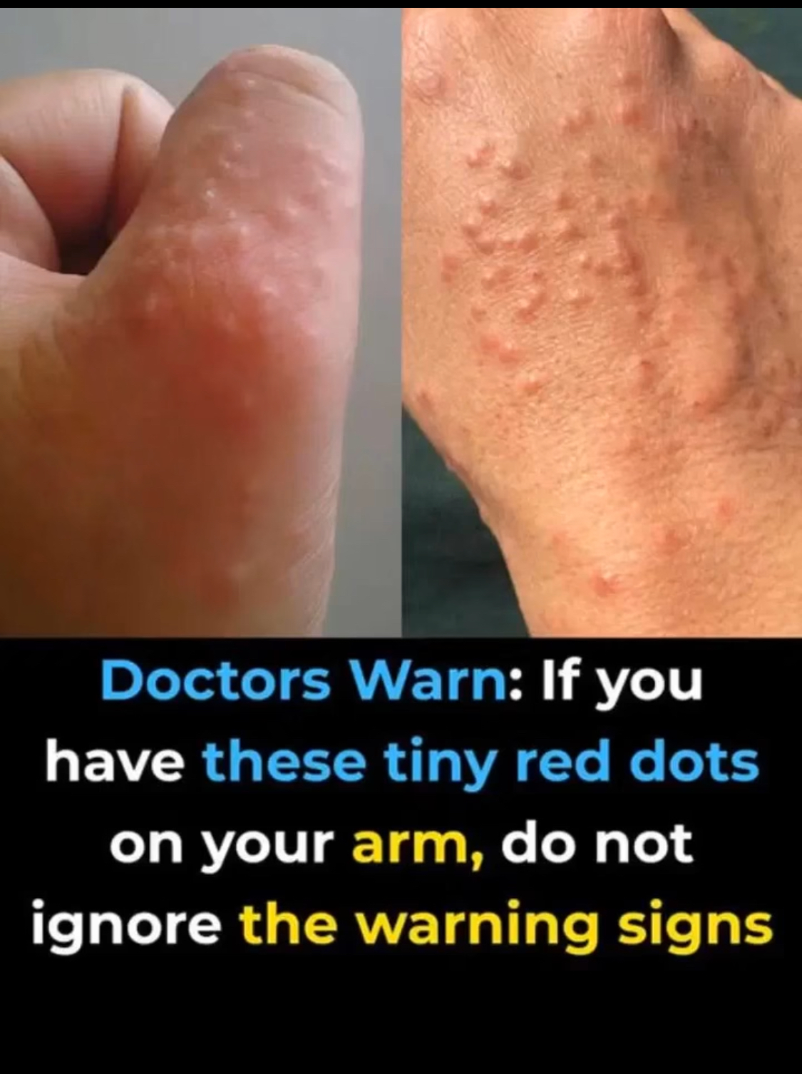 Don’t overlook these small red spots on your arm – They could be important w.arning signs