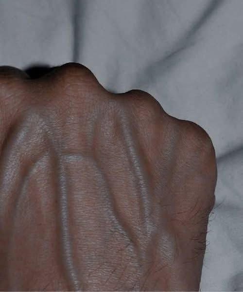 When To Worry About Suddenly Visible Veins: What Your Body May Be Telling You