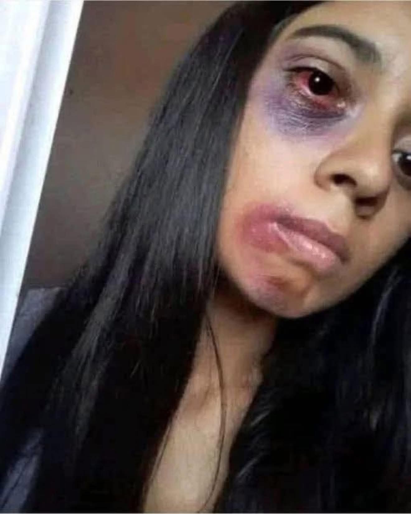 Young woman dies at the hands of her… See more
