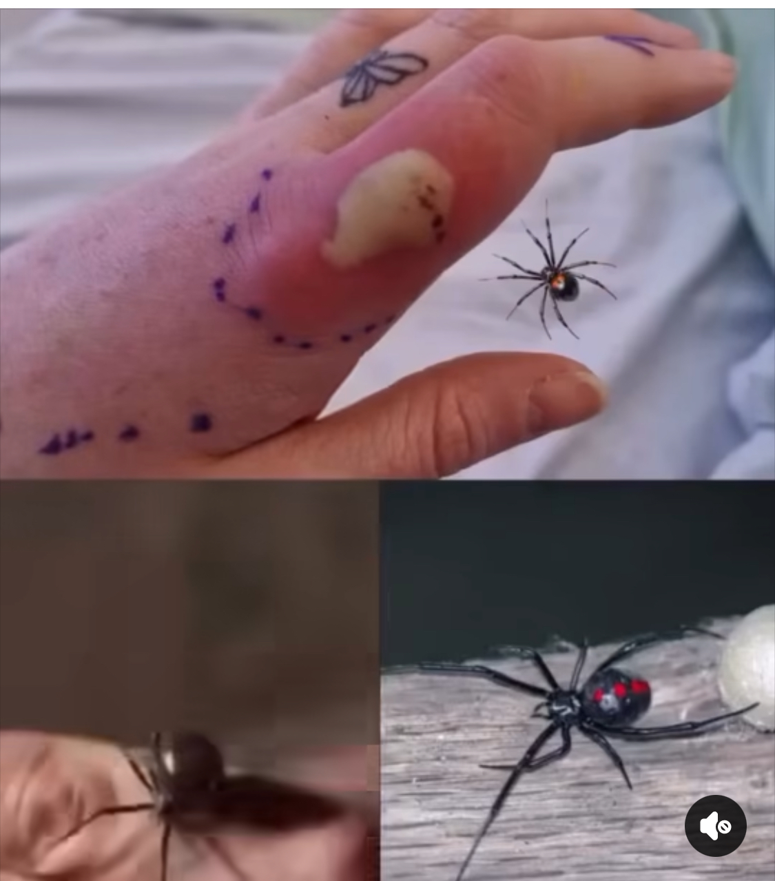 What to do if you get bit.ten by a black widow spider ⁉ A complete guide in COMMENT