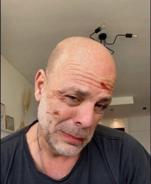 Bruce Willis, with heavy hearts – See Details