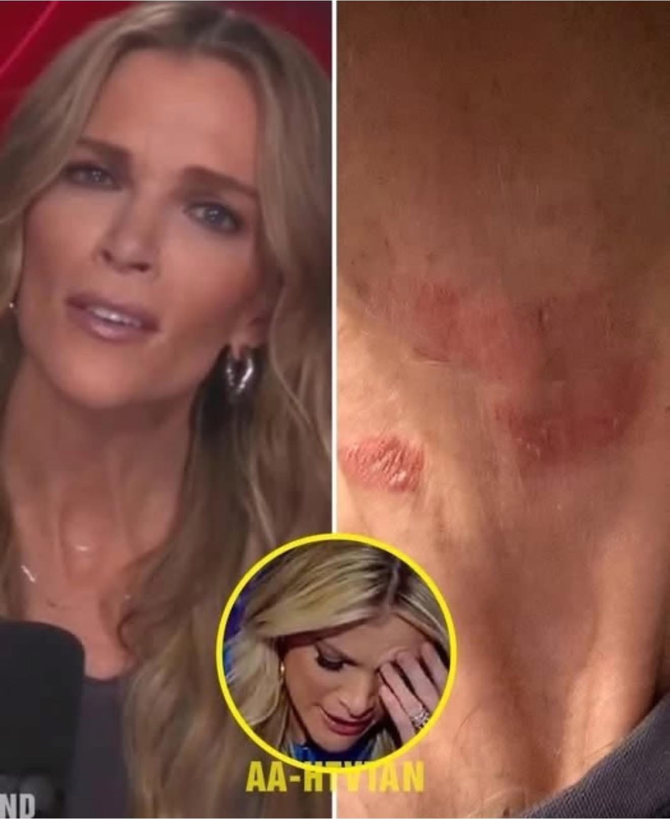Megyn Kelly Hospitalized in Critical Condition… See more