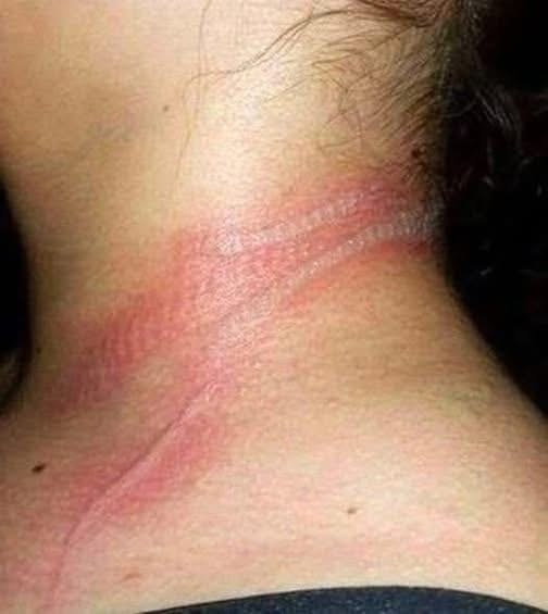 She looked at her little girl and saw devastating wounds on her neck. When she realized what had happened, she was beside herself Be careful, because it can happen to your child as well Full story in Comments