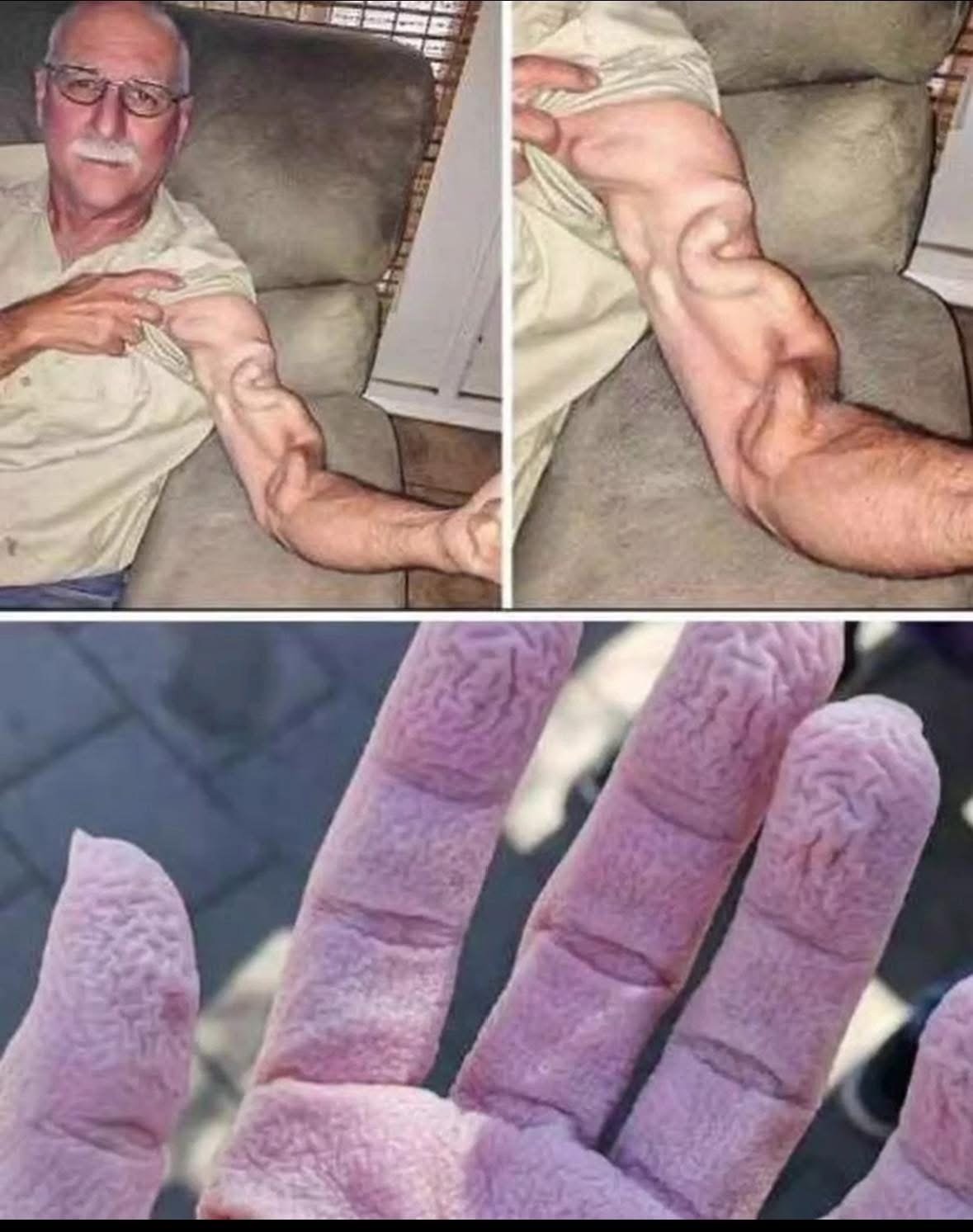 A man goes to stretch and ends up feeling a sharp pain in his arm, it was a ca…